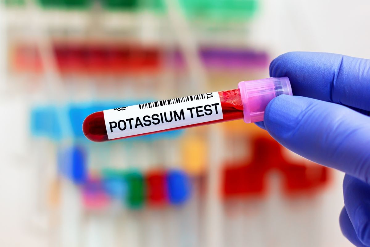 Un déficit en potassium : un signal d'alerte pour votre santé
